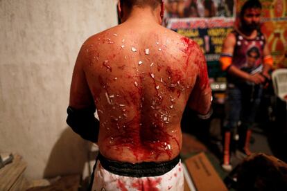 Pero al final de la noche todo el mundo se abraza y elogia las habilidades físicas del otro. En la imagen, el luchador Cíclope muestra su espalda después de un combate, en Tulancingo Hidalgo (México).