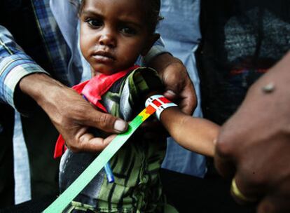 Medición del perímetro braquial de una niña durante la emergencia nutricional de Oromia (Etiopía) en 2008. Un MUAC rojo como este indica desnutrición aguda severa.
