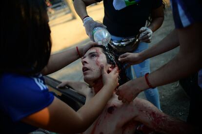 Un manifestante herido con un perdigón recibe asistencia durante una protesta contra el Gobierno del presidente chileno Sebastián Piñera en Santiago (Chile).