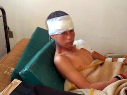 Menino ferido em um hospital de Hama (Síria).