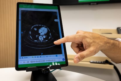 Más de 2.500 facultativos han empleado 'Scribe' en los 50 hospitales del grupo en España.