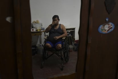 Un paciente con lepra, en el Curupaiti Colonial hospital en Rio de Janeiro (Brasil) en noviembre de 2021