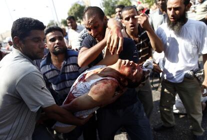 Herido durante los disturbios entre partidarios del presidente derrocado Mohamed Morsi y el ejército egipcio, en el exterior de la sede de la Guardia Republicana, 5 de julio de 2013.