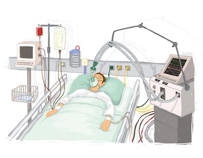 Dibujo de un paciente con asistencia respiratoria