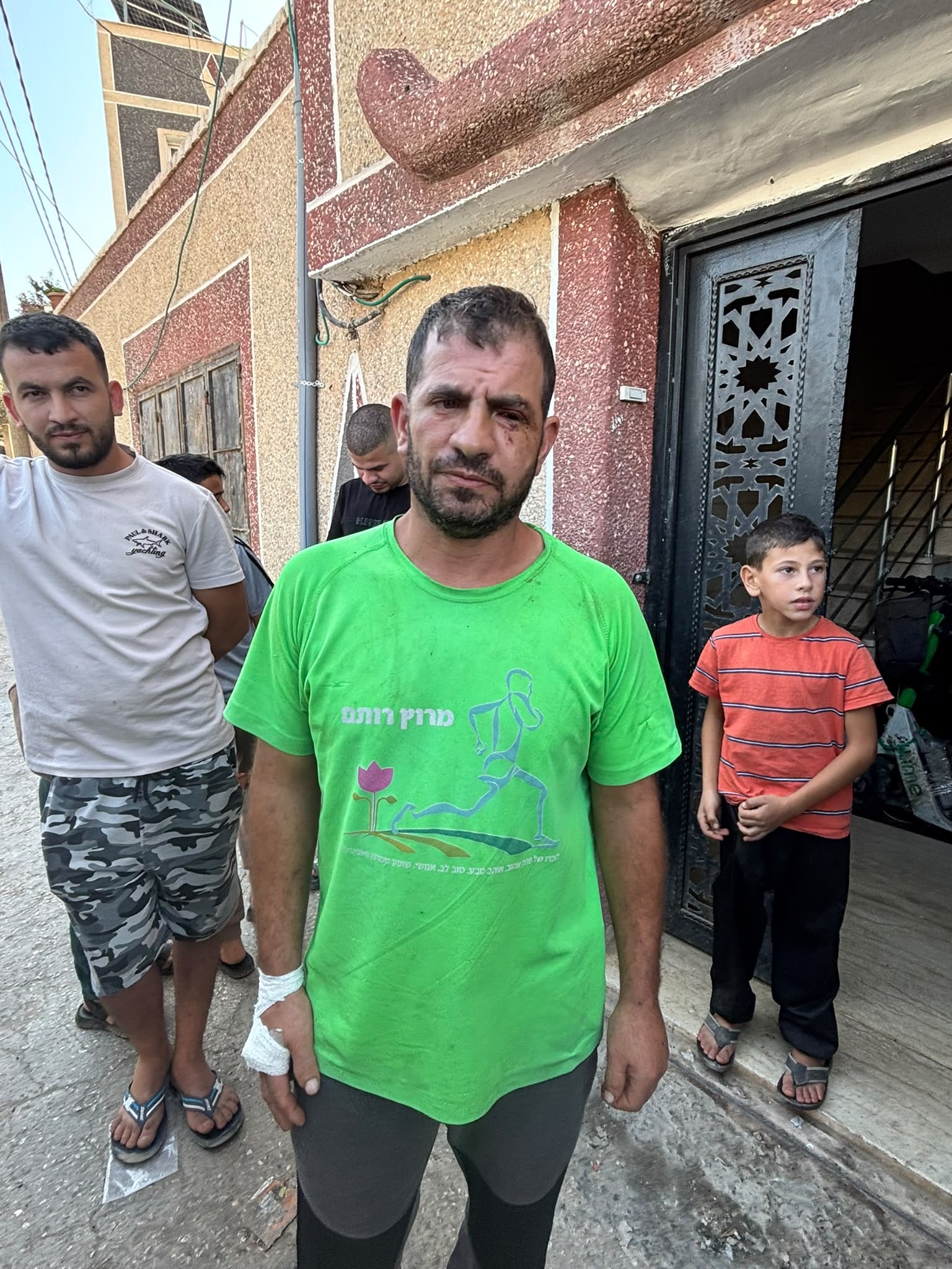 Mahram Abdala, herido por colonos israelíes cuando recogía aceitunas en Deir Balut, en Cisjordania, en octubre de 2026.