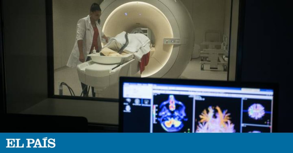 Que Pasaria Si No Tuvieramos Sistema Nervioso elpais.com