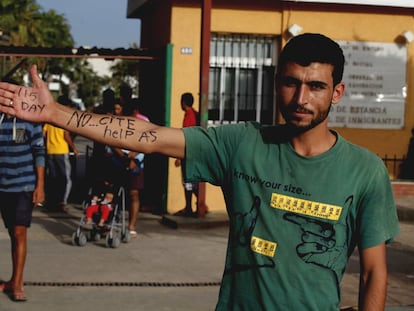 Un ciudadano sririo residente en el CETI de Melilla escribe en su brazo pidiendo ayuda.