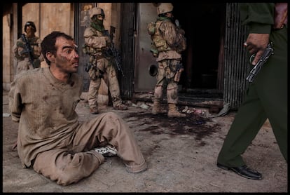 Un prisionero herido durante los primeros días de la guerra de Irak, en 2003. 