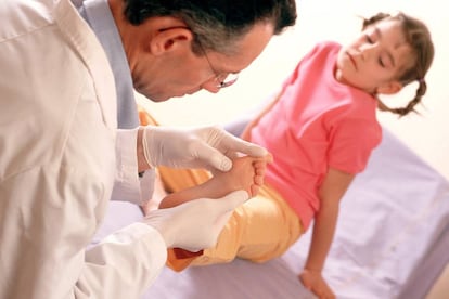 Doctor observa la verruga de una niña en el pie.