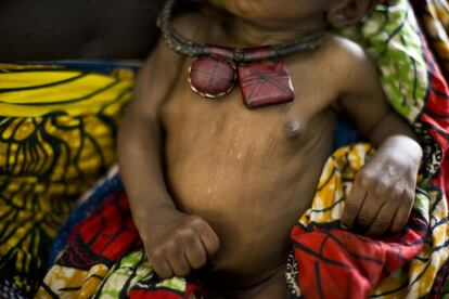 Niño con amuletos tradicionales. Antes de recurrir al hospital, las madres utilizan la medicina tradicional para intentar curar a sus hijos. Los tratan con hierbas medicinales y fetiches. Los médicos consideran fundamental estar alerta en caso de que los remedios tradicionales no alcancen a solucionar el problema y desplazarse al hospital a tiempo de poder tratarlo con más medios.