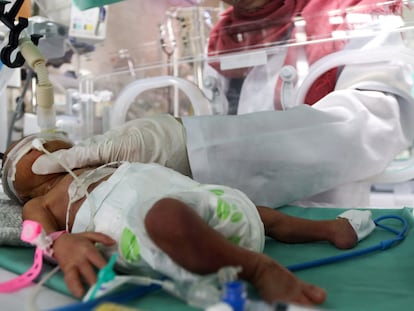 Una médica asiste a un bebé prematuro en el hospital.