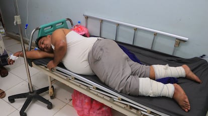 Un hombre herido en el ataque israelí recibe asistencia médica en el hospital Al Thawrah de Hodeida, en Yemen, este domingo.