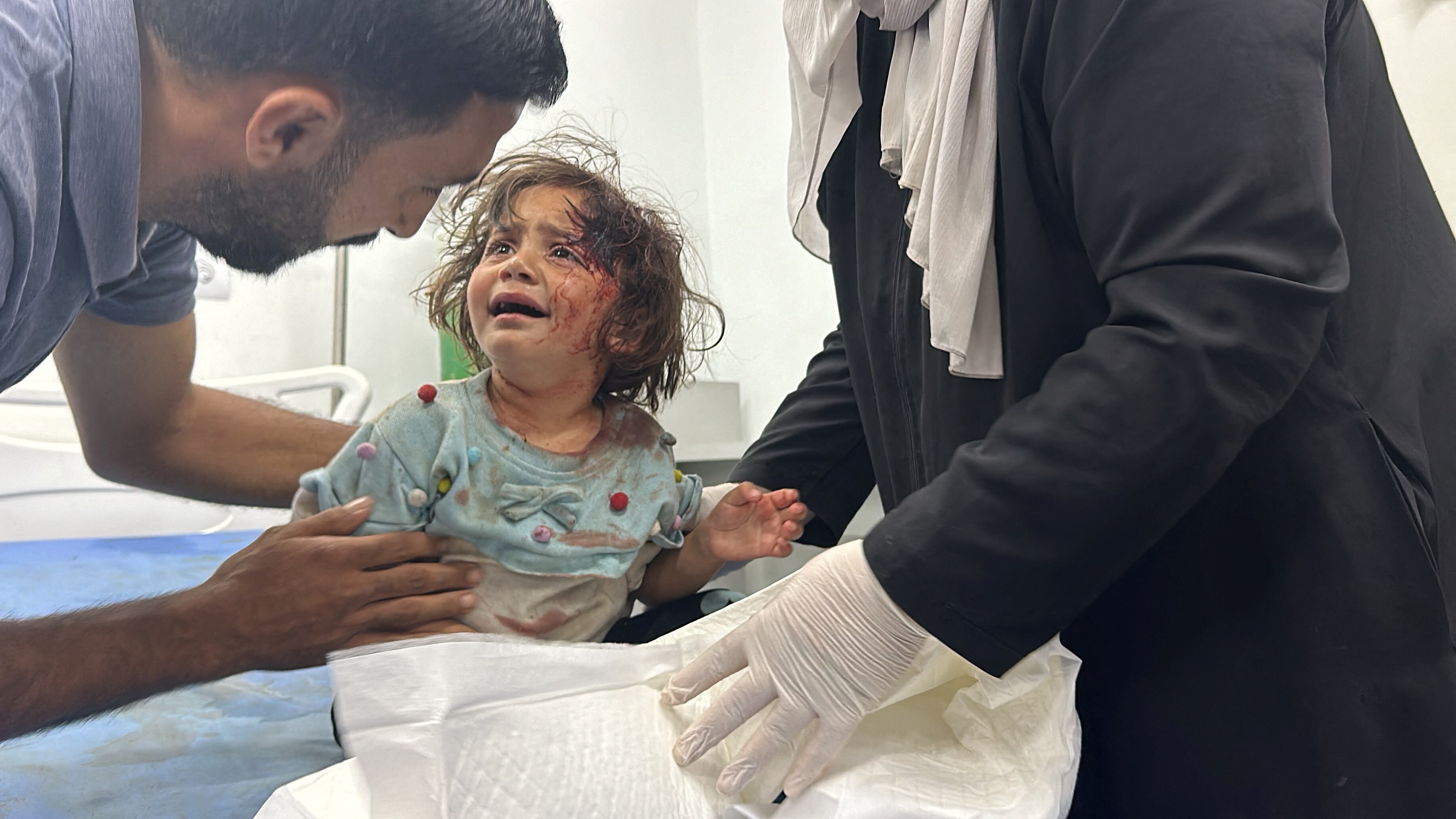 Una niña palestina recibe atención médica tras resultar herida por un bombardeo israelí sobre un campo de desplazados en Rafah, este lunes.  