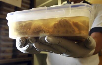 Muestras de cerebro del Centro de Investigación de Tejidos Cerebrales de la Universidad de Harvard