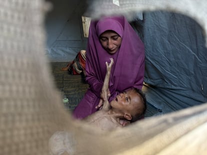El pequeño gazatí Mohamed Motawaq, de tan solo 18 meses, de cuerpo esquelético pasa los días en Gaza en brazos de su madre, Hidaya al Mutauaq, un mujer viuda, de 30 años, sin apenas leche y otros productos básicos por las restricciones que Israel.
