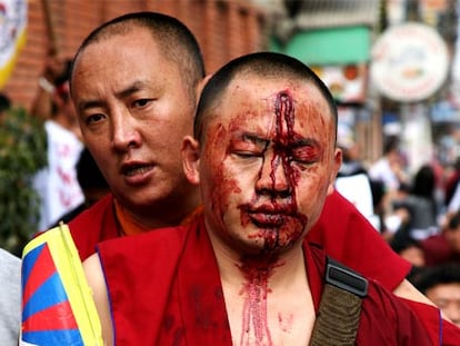 Un herido tibetano en las protestas contra China