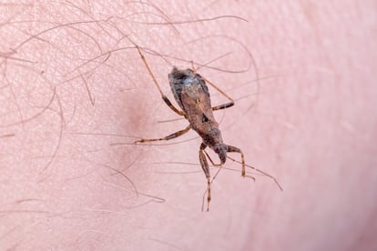 Una vinchuca, una chinche transmisora de la enfermedad del Chagas, sobre la mano de una persona.