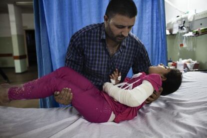 Ashour lleva en brazos a su hija de nueve años hasta una cama de urgencias del hospital. La familia fue evacuada de su casa y se refugió en una escuela de la ONU. La pequeña vio bombardeos cerca y se rompió el brazo cuando cayó mientras intentaba huir.