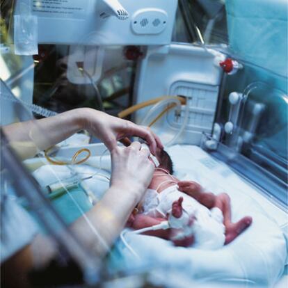 Un bebé prematuro recibiendo todo tipo de cuidados.
