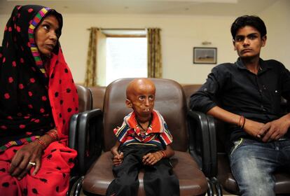 El joven Rupesh (c) de 21 años, que padece de progeria, junto a su madre y hermano menor en la Oficina de Magistrados del Distrito de Allahabad en busca de apoyo financiaro para su tratamiento, en Allahabad (India).