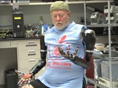 Ya no es ciencia ficción, llega el primer hombre con brazos robóticos