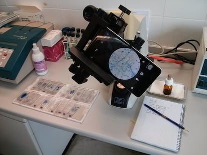 Digitalización de las muestras de tuberculosis que se usan en el juego Tuberspot.