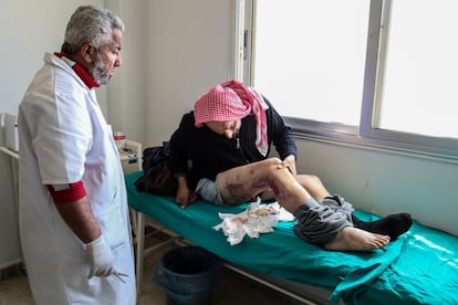 Un hombre herido por una mina antipersona es atendido por un doctor en uno de los centros de MSF en Al Bab (Siria).