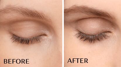 Results before and after using this treatment.
