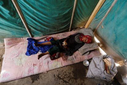 Una niña enferma se encuentra dentro de una tienda de un campamento para desplazados internos cerca de Saná, Yemen.