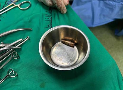 Bala israelí encontrada en el cuerpo de Abdul Rahman, de 16
años, tras ser extraída por los cirujanos. Presentaba heridas de bala en tórax y abdomen. Abdul Rahman fue atacado mientras esperaba recibir comida del centro de distribución de comida que los israelíes, junto con una compañía
estadounidense, han habilitado en Rafah. (Jan Yunis, 3 de junio de 2025).