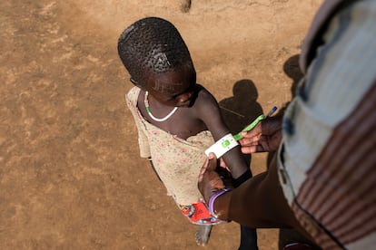 Examen nutricional en la aldea de Kalojuka, en la región de Karamoja Uganda