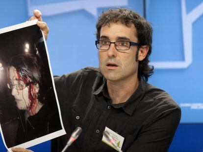 El parlamentario de EH Bildu Julen Arzuaga, muestra una foto de la senadora de Amaiur, Amalur Mendizabal, herida en una carga de la Ertzaintza.