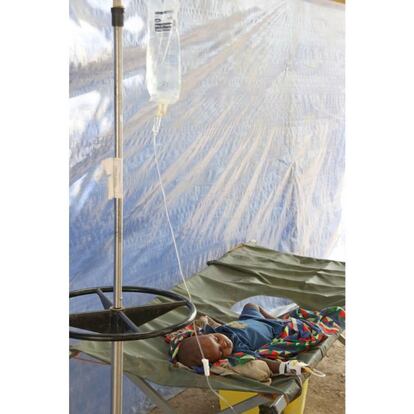 Bebé enfermo de cólera internado en las carpas de emergencia de Médicos sin Fronteras.