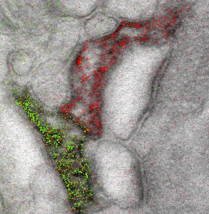 Muestra multicolor tomada por un microscopio electrónico.