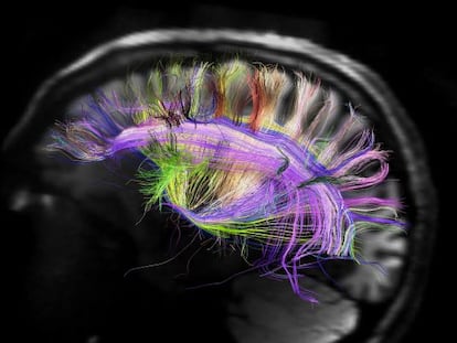 Una resonancia magnética del cerebro humano.