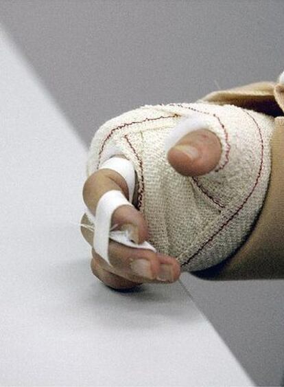 La mano de Dani Pedrosa tras la operación