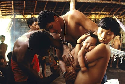 Doctor examina a bebé yanomami enfermo, Balaú, 1996.
 