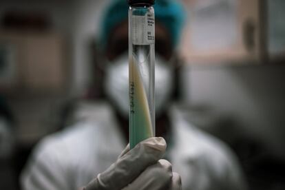 Un cultivo de esputo para saber si una persona padece tuberculosis