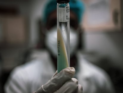 Un cultivo de esputo para saber si una persona padece tuberculosis