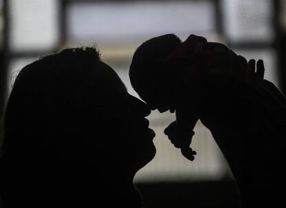 Una mujer brasileña sostiene a su nieta, de un mes de vida, con microcefalia a causa del Zika.