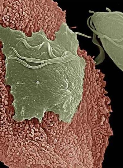 Imagen al microscopio del tricomonas adherido a una célula epitelial de la vagina.