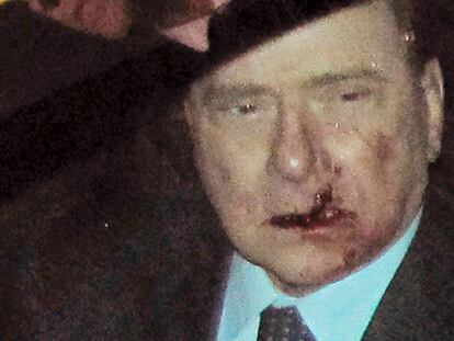 Berlusconi, de camino al hospital tras la agresión.