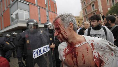 Un ferit a l'escola Mediterrània de la Barceloneta.