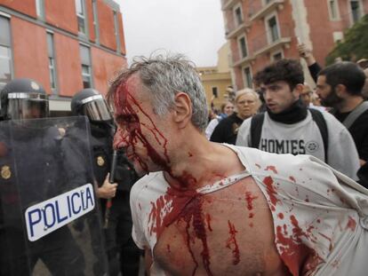 Un ferit a l'escola Mediterrània de la Barceloneta.