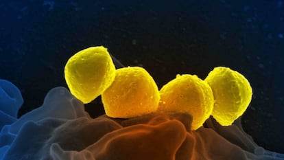 Streptococcus pyogenes o bacteria asesina