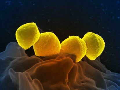 Un grupo de la bacteria ‘Streptococcus pyogenes’.
