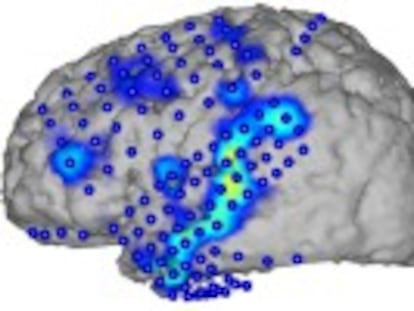Investigadores logran traducir las señales eléctricas del cerebro en palabras y frases completas