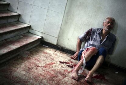 Un herido se sienta en el suelo de un improvisado hospital en la ciudad de Duma tras un ataque de la aviación siria. El número de muertos documentados y verificados en el conflicto armado en Siria desde marzo de 2011 hasta abril de este año es de 191.369 personas, casi 9.000 de ellas menores de edad, según la ONU.