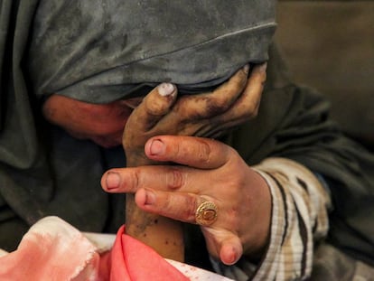 Buthayna Abu Jazar rests her head on the hand of her son Hamza, who died in an Israeli airstrike in Rafah on May 9, 2024.