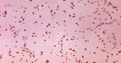 Imagen microscópica de bacterias de gonococo.